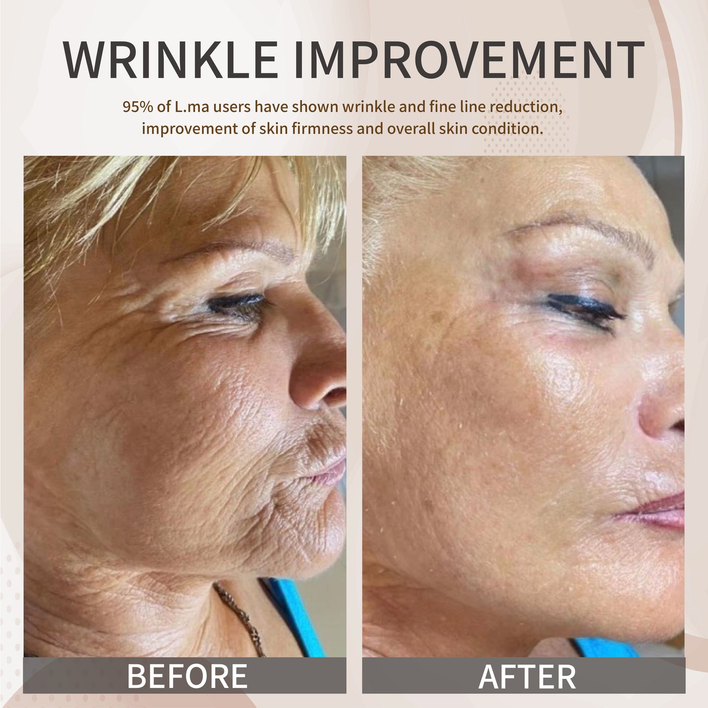 L.ma LED Gezichtsmasker_VITSRO PREMIUM LED SKIN CARE DEVICE